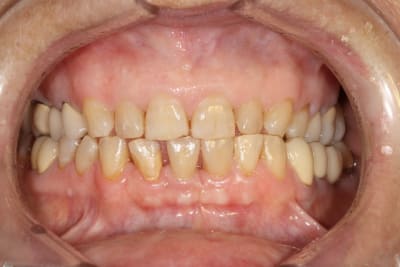 Img 1197 icdslb - Eugenol