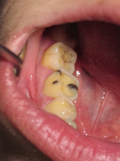 Img 1270 cuhqr5 - Eugenol