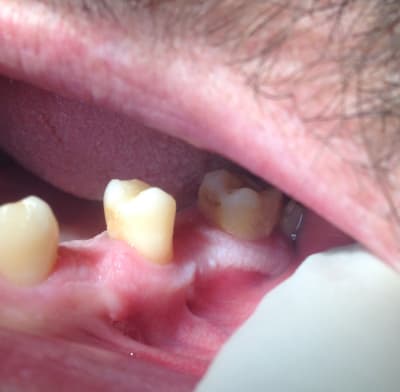 Img 1329 echmda - Eugenol