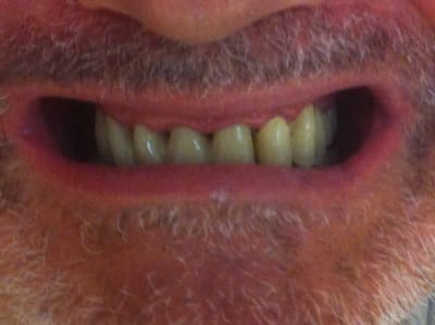 Img 1363 as8ybb - Eugenol