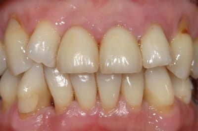 Img 1401bis  medium  lnhiqz - Eugenol