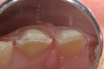 Img 1493 jplssl - Eugenol