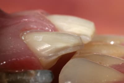 Img 1496 xwj6gn - Eugenol