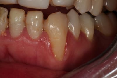 Img 1528 lud4dz - Eugenol