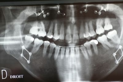 Img 1532 dyrslt - Eugenol