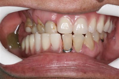 Img 1609  small  zdyk0i - Eugenol