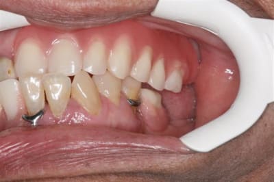 Img 1610  small  s1itv7 - Eugenol