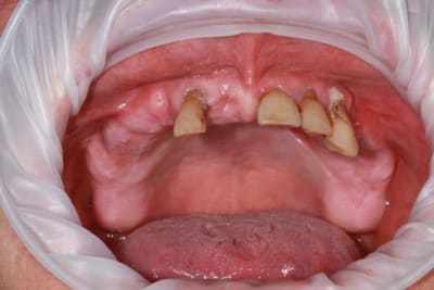 Img 1670 ie4unw - Eugenol