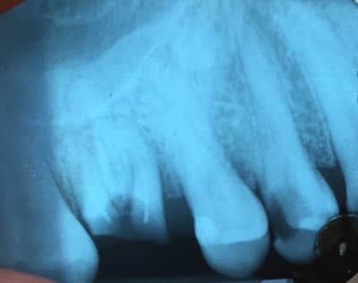 Img 1675 q3dw5b - Eugenol