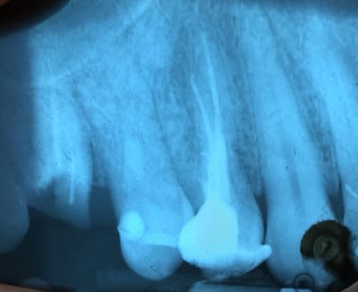 Img 1678 m3blwz - Eugenol