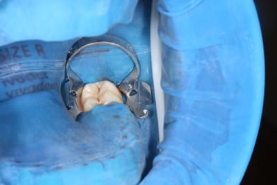 Img 1706 rci96f - Eugenol