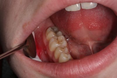 Img 1743 kktbwg - Eugenol