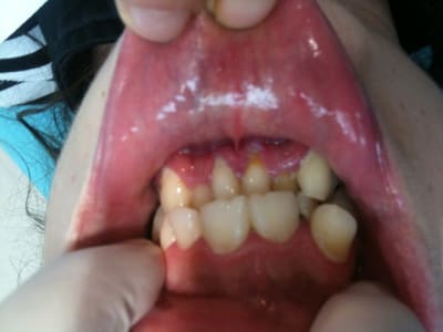 Img 1854 1  hwyoh2 - Eugenol