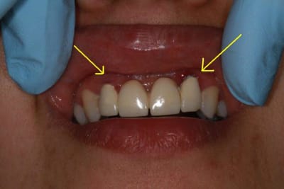 Img 1857r cxv5g1 - Eugenol