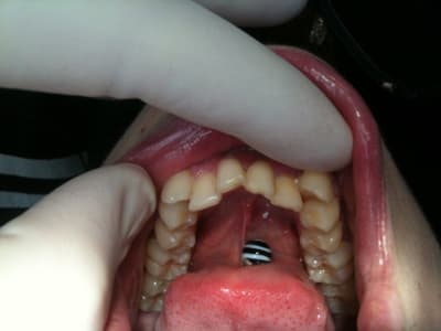 Img 1858 1  kooxgt - Eugenol