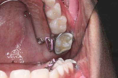 Img 1870 novbbx - Eugenol