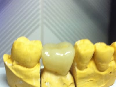 Img 1870 qdynpt - Eugenol