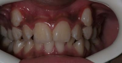 Img 1 bgeubs - Eugenol