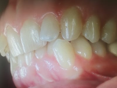 Img 20171129 145715 bc5tue - Eugenol