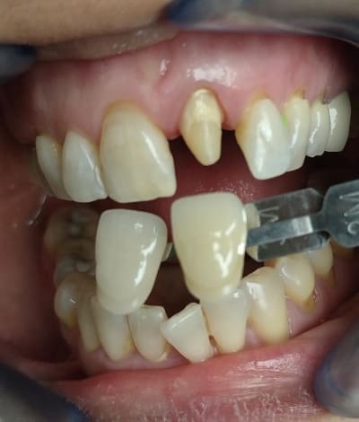 Img 20190603 092320 swipzh - Eugenol