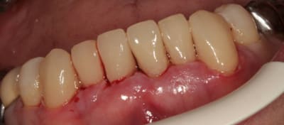 Img 2022w qcmndm - Eugenol