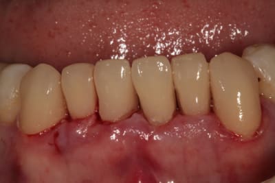 Img 2026w mildow - Eugenol