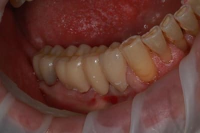 Img 2119 bfhxug - Eugenol