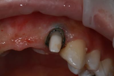 Img 2181 yijzhz - Eugenol