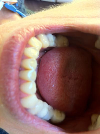 Img 2226 garc8z - Eugenol