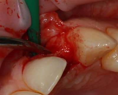 Img 2229r unyojw - Eugenol