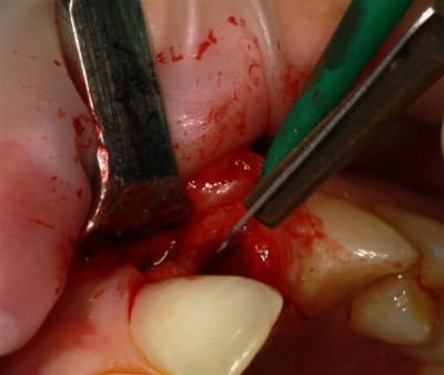 Img 2232r dtwe1e - Eugenol