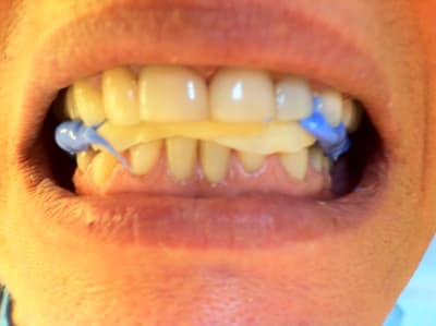 Img 2234 kj9b7k - Eugenol