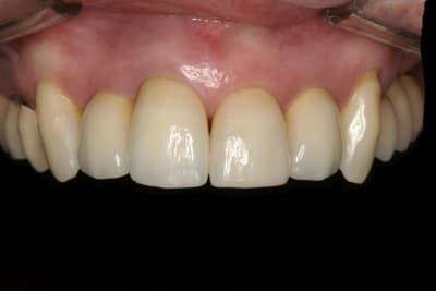 Img 2242 2 2 v1yyou - Eugenol