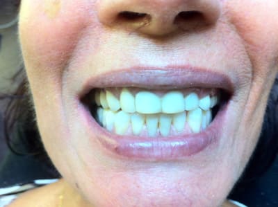 Img 2250 hj4wxi - Eugenol