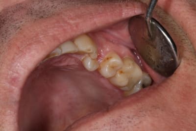 Img 2252 seie9t - Eugenol