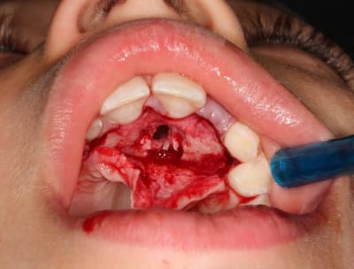 Img 2258 uwuj2c - Eugenol