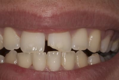 Img 2299 xk1loc - Eugenol