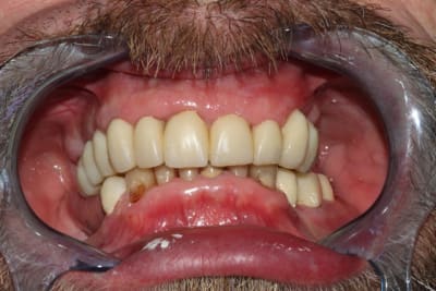 Img 2324 foyb0q - Eugenol