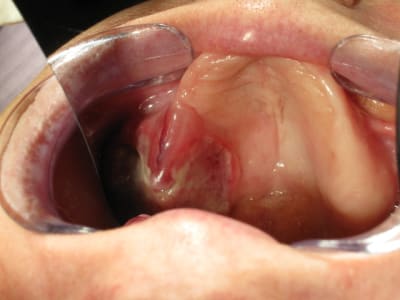 Img 2379 dn1rkb - Eugenol