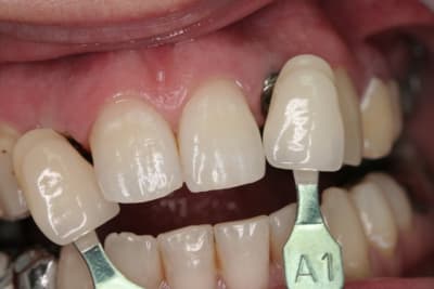 Img 2640 m63aup - Eugenol