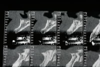 Img 2642 h3keuz - Eugenol