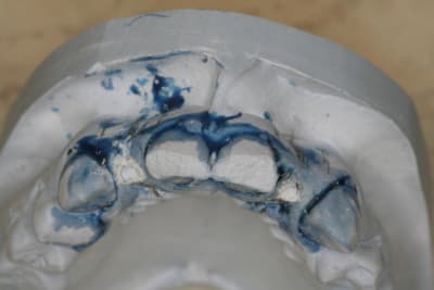 Img 2647 y4doy9 - Eugenol