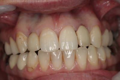 Img 2655 fabrqz - Eugenol