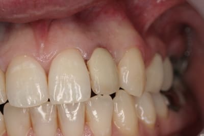 Img 2656 uds9dq - Eugenol