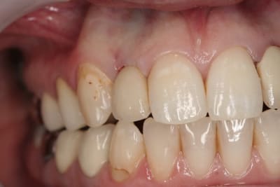 Img 2657 gvssvl - Eugenol