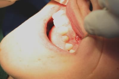 Img 2670 lovzcc - Eugenol