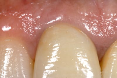 Img 2743 chxljm - Eugenol