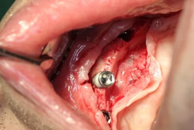 Img 2785 namla2 - Eugenol