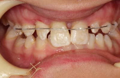 Img 2787 j0scqr - Eugenol