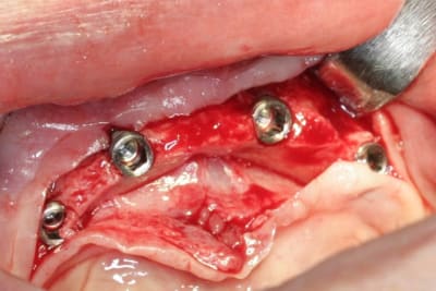 Img 2788 soxekq - Eugenol